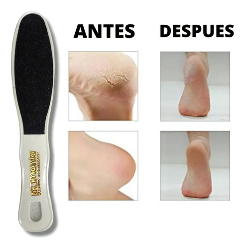 Escova de calcanhar de 6 peças que remove aspereza e calosidades Pomania