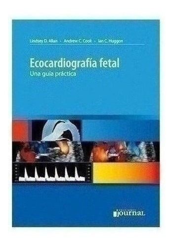 Ecocardiografía Fetal - Allan, Lindsey D. (papel)