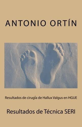 Libro: Resultados De Cirugía De Hallux Valgus En Hgue: Resul