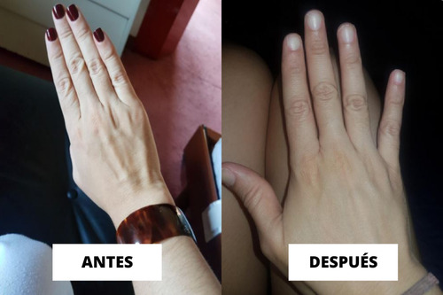 Removedor De Esmalte Instantáneo