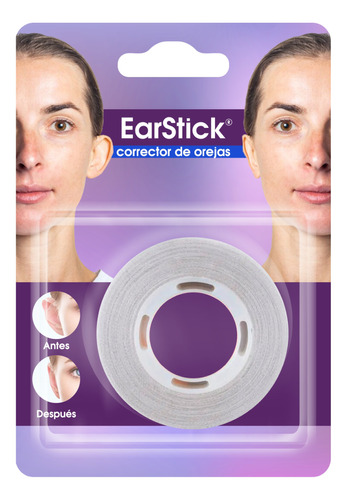 Corrector Orejas Separadas Bebe Estetico Ear Stick Oto Oreja