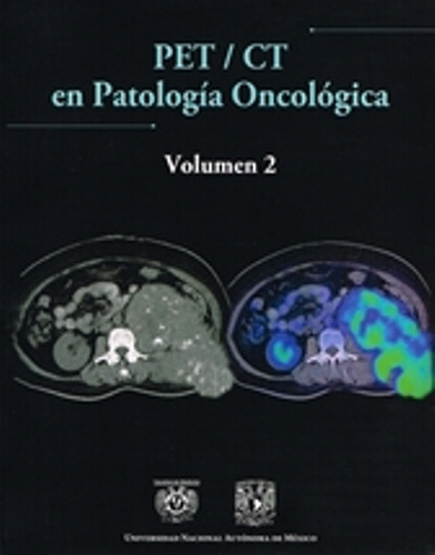 Petct En Patología Oncológica