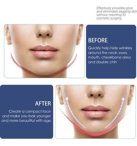 Fita Facial Para Levantamento De Fita Facial Invisível Fita