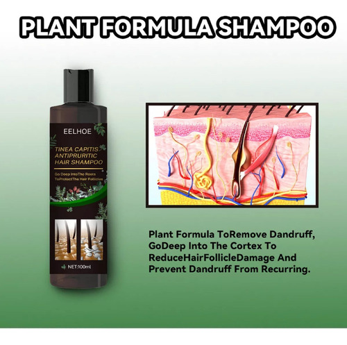 Champú Antipicazón X Para La Tiña De La Cabeza, La Caspa