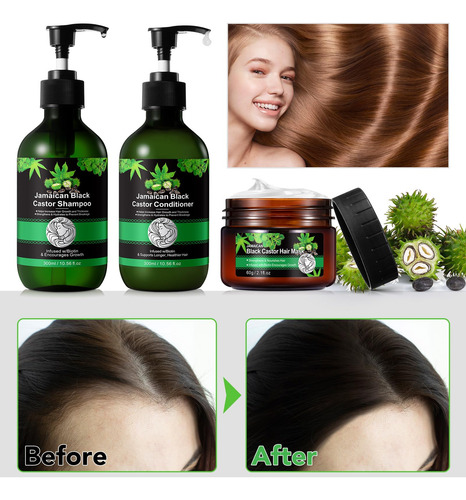 Set Para El Cuidado Del Cabello Rtbyue Aceite De Ricino Negr