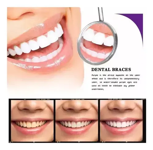Creme Dentário Branqueador Smile-ease V34/repara 2 Unidades