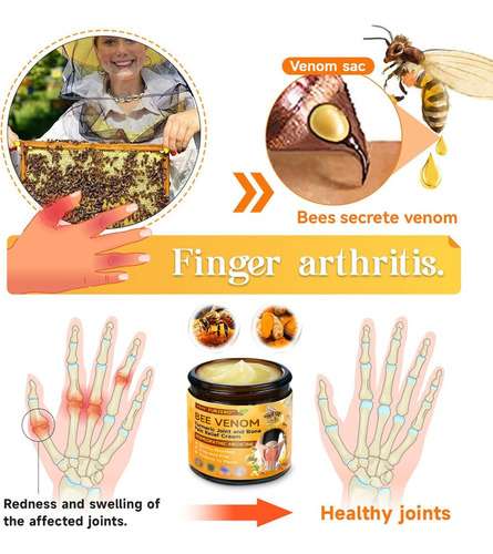 Crema Para Aliviar El Dolor De Articulaciones Y Huesos Con C
