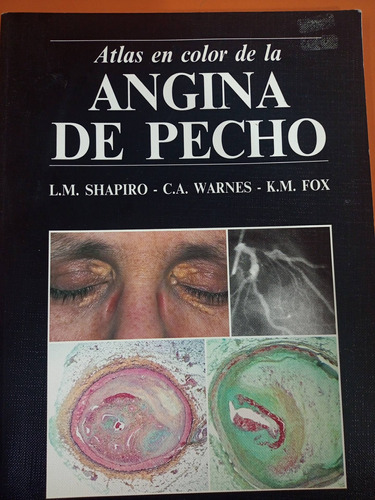 Atlas En Color De La Angina  De Pecho 