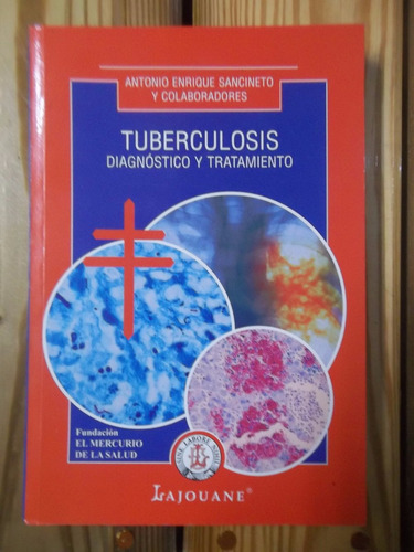 Tuberculosis Diagnostico Y Tratamiento Antonio Sancineto.230