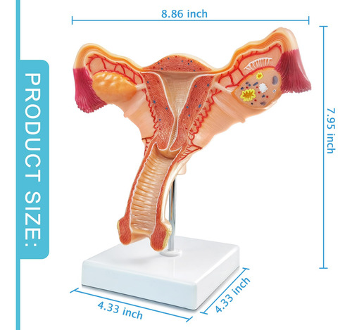 Modelo Anatomico De Utero Y Ovario Humano Para Educacion