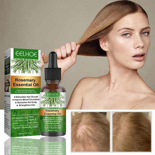 . Óleo De Alecrim Para Fortalecer Couro Cabeludo E Cabelo