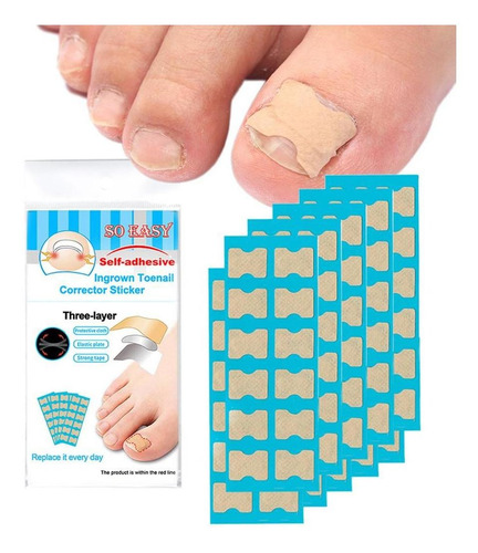 Tiras De Pegatinas De Corrección De Uñas Kit De 120 Hojas