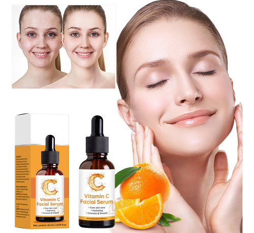 EssĂȘncias De Vitamina C Hidratam A Pele E Iluminam O Tom De