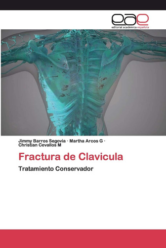 Libro: Fractura De Clavicula: Tratamiento Conservador (spani