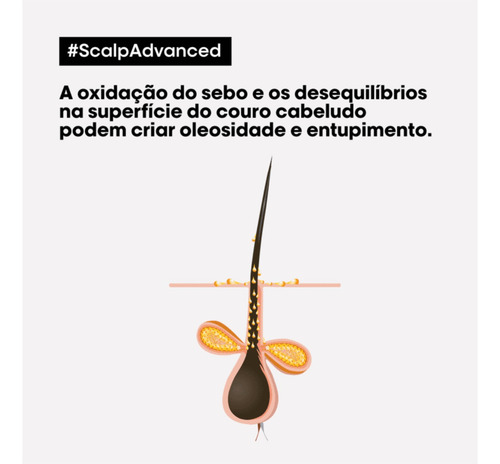 L'oréal Scalp Advanced Anti Gras Oilness Shampoo 300ml