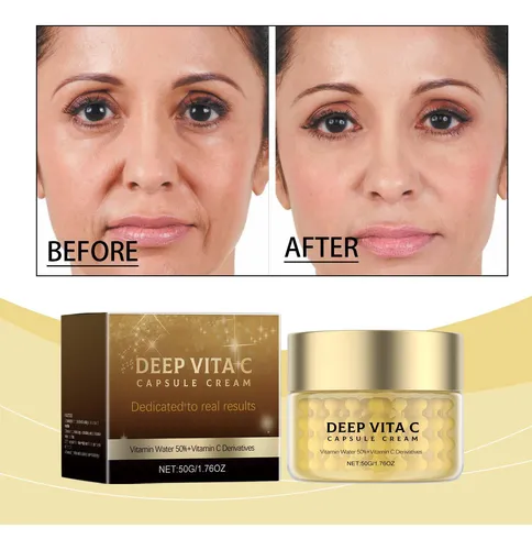 Crema Hidratante Antiarrugas Con Vitamina C U Vitamina C A 0