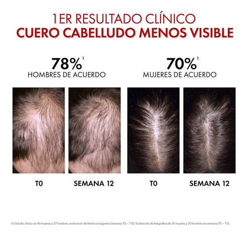 Vichy Dercos Serum Anti-caídaaminexil Clinical Regen 90ml