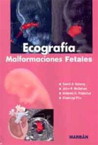 Ecografia En Malformaciones Fetales - Nyberg, David,,,