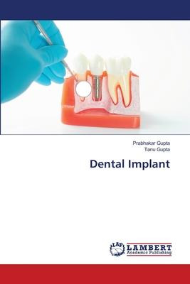 Libro Dental Implant - Prabhakar Gupta