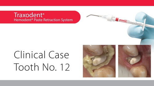 Traxodent, Retractor Y Hemostático Gingival C/2 Jeringas