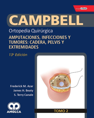 2 Amputaciones Infecciones Y Tumores - Ortopedia Q - Azar Ca