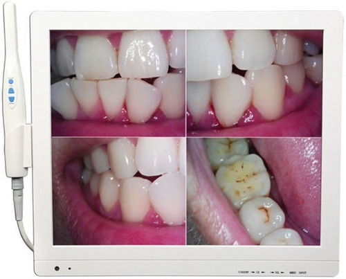 Camara Intraoral Con Monitor Y Tv Led Dental Odontologia 