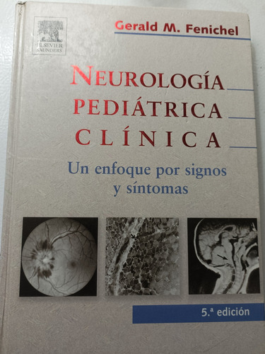 Neurología Pediátrica Clínica.