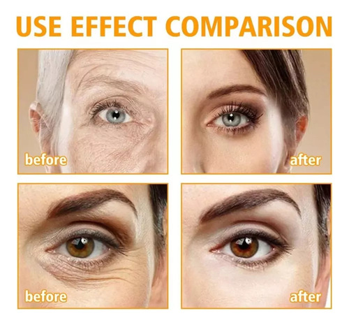 Crema Reafirmante For Ojos, Elimina Bolsas Y Ojeras ,
