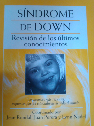 Sindrome De Down