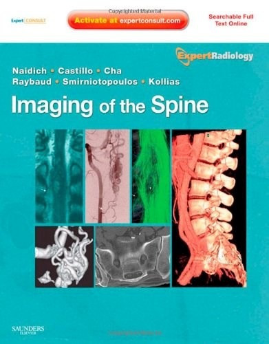 Imaging Of The Spine - Naidich, Thomas P. (papel)