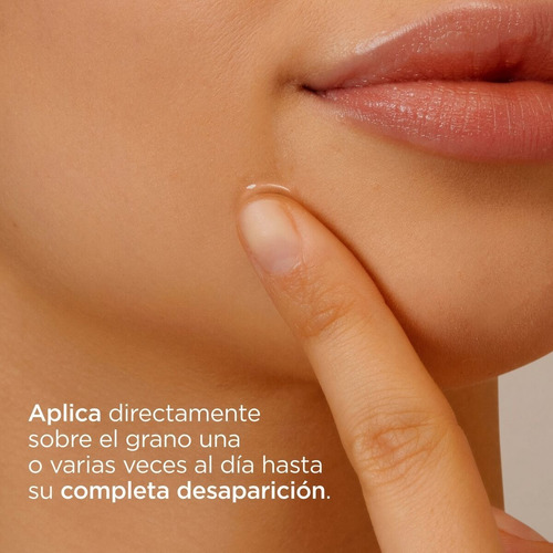 Imagen 2 de 6 de Gel Acniben Corrector De Granos Faciales 15ml Isdin