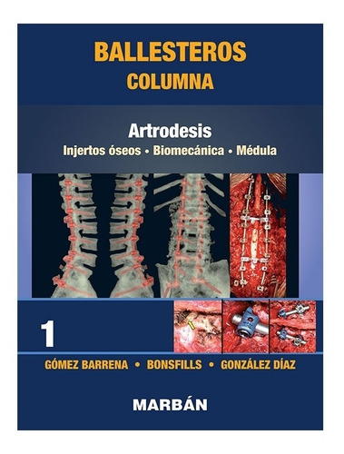 Ballesteros. Columna Tomo 1: Artrodesis