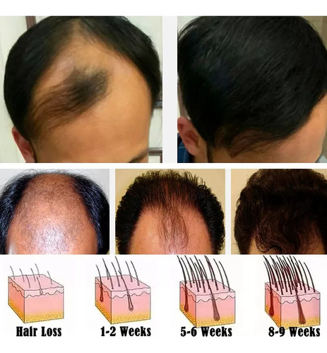 6*scalp Hair Serum For Hair Growth