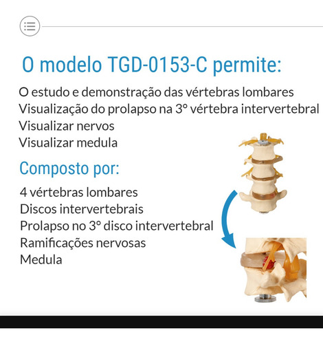 4 Vértebras Lombares Discos Intervertebrais Medula Prolapso