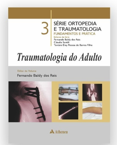 Traumatologia Do Adulto