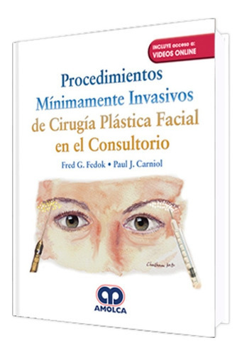 Procedimientos Mínimamente Invasivos En Cirugía Plástica Facial En El Consultorio, De Fred G. Fedok - Paul J. Carniol. Editorial Amolca, Tapa Dura En Español, 2018