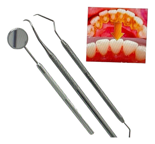 Kit Limpieza Dental Sonda, Espejo Y Extractor