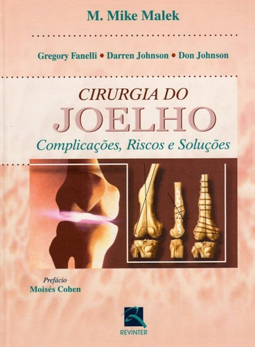 Cirurgia Do Joelho - Complicações, Riscos E Soluções - Malek, De Malek. Editora Revinter, Capa Dura Em Português, 2003