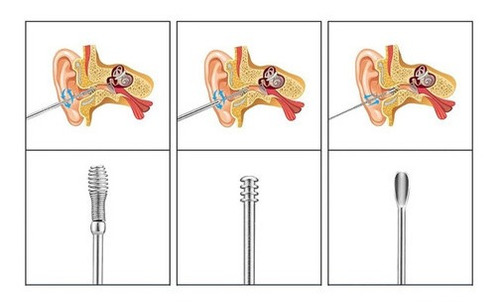 3 Jgos Accesorios Remover Cera Cuidado Limpieza Oídos