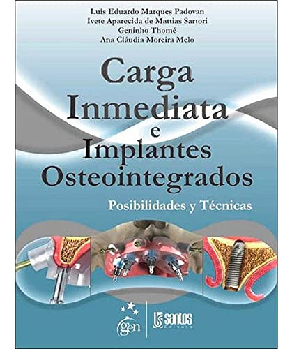 Libro Carga Inmediata E Implantes Osteointegrados De Luis Ed