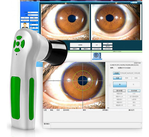 Cámara De Iridología Usb 12mp Con Software Pro Y Lente 30x