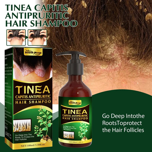 Shampoo Anti-coceira Scalp Seborreic Hair Shampoo Cream Rem