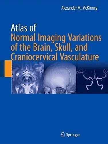 Atlas Of Normal Imaging Variations Of The Brain, Skull, And