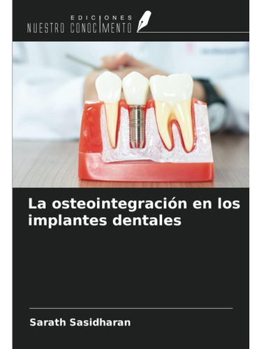 Libro: La Osteointegración En Los Implantes Dentales (spanis