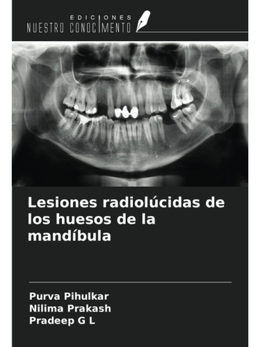 Libro: Lesiones Radiolúcidas De Los Huesos De La Mandíbula (