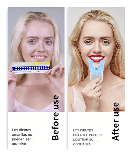 Aparato Para Blanquear Los Dientes Gel De Dientes Que Aclara