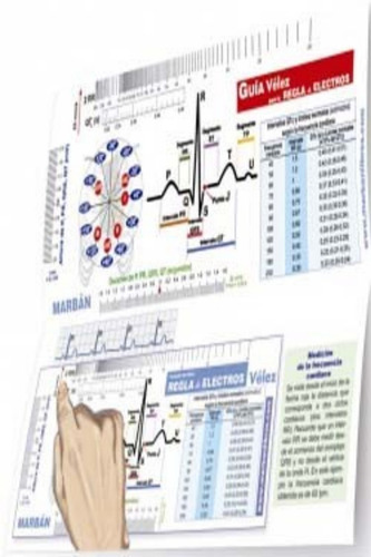 Guía Vélez Para La Regla De Electros. Cardiología. Marban