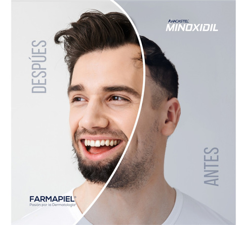 Imagen 8 de 8 de 3 Piezas De Minoxidil 5% Anacastel Liquido Acelerador De Crecimiento Y Fortalecimiento De Cabello