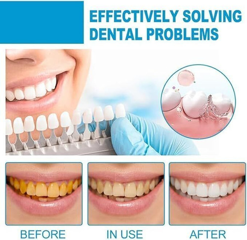 - Creme Dental Probiótico Sp-4 De Clareamento Rápido