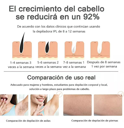 Depiladora a laser permanente Babeefly com luz pulsada Ipl 999.999 Máquina de depilação a laser Ipl rosa Depiladora a laser Depiladora a laser Depiladora a laser Depiladora a laser permanente